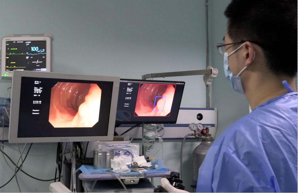Artificial Intelligence in Colon Polyp Diagnosis: How AI is Transforming Colonoscopy and Early Cancer Detection